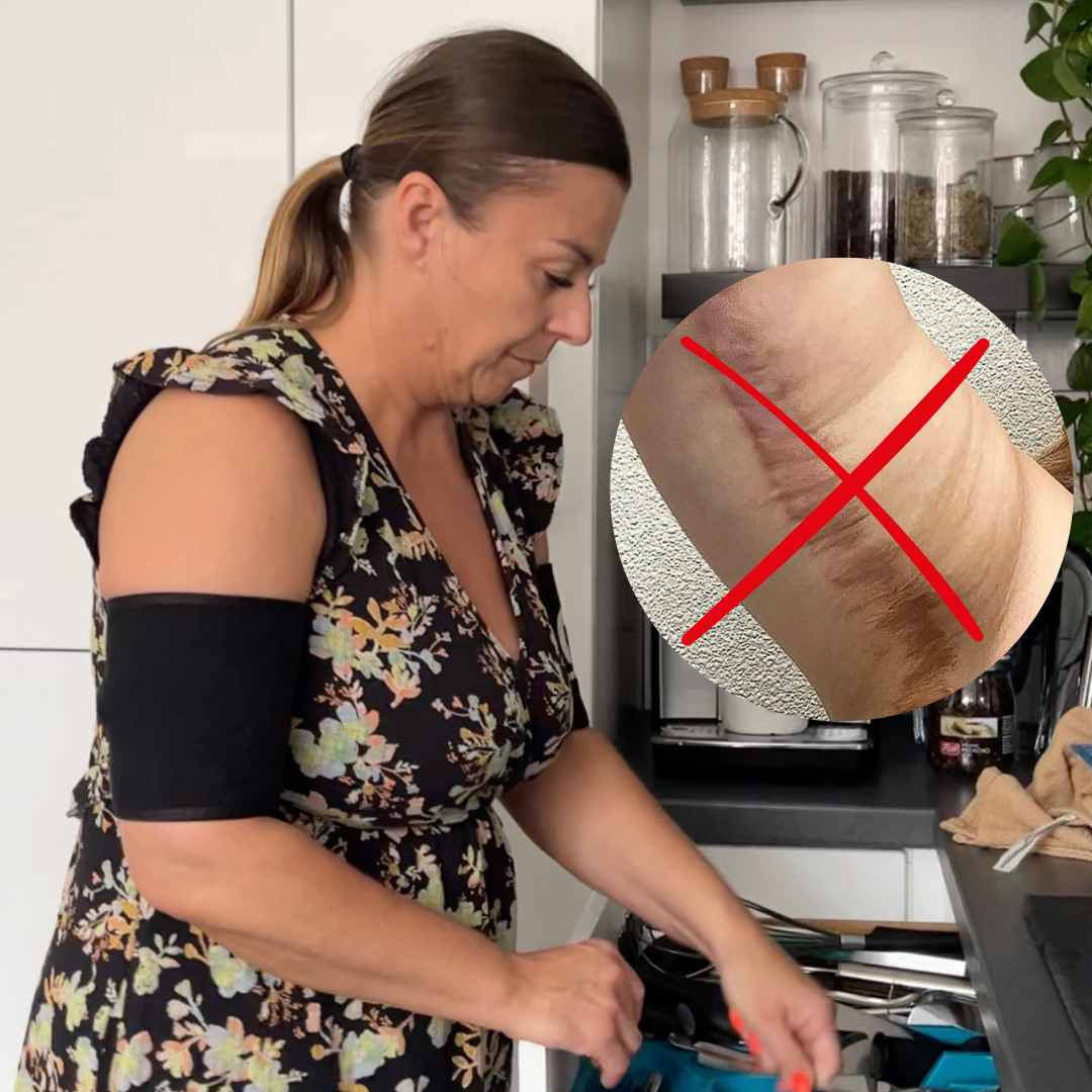 A Safe, Simple Alternative to Surgery