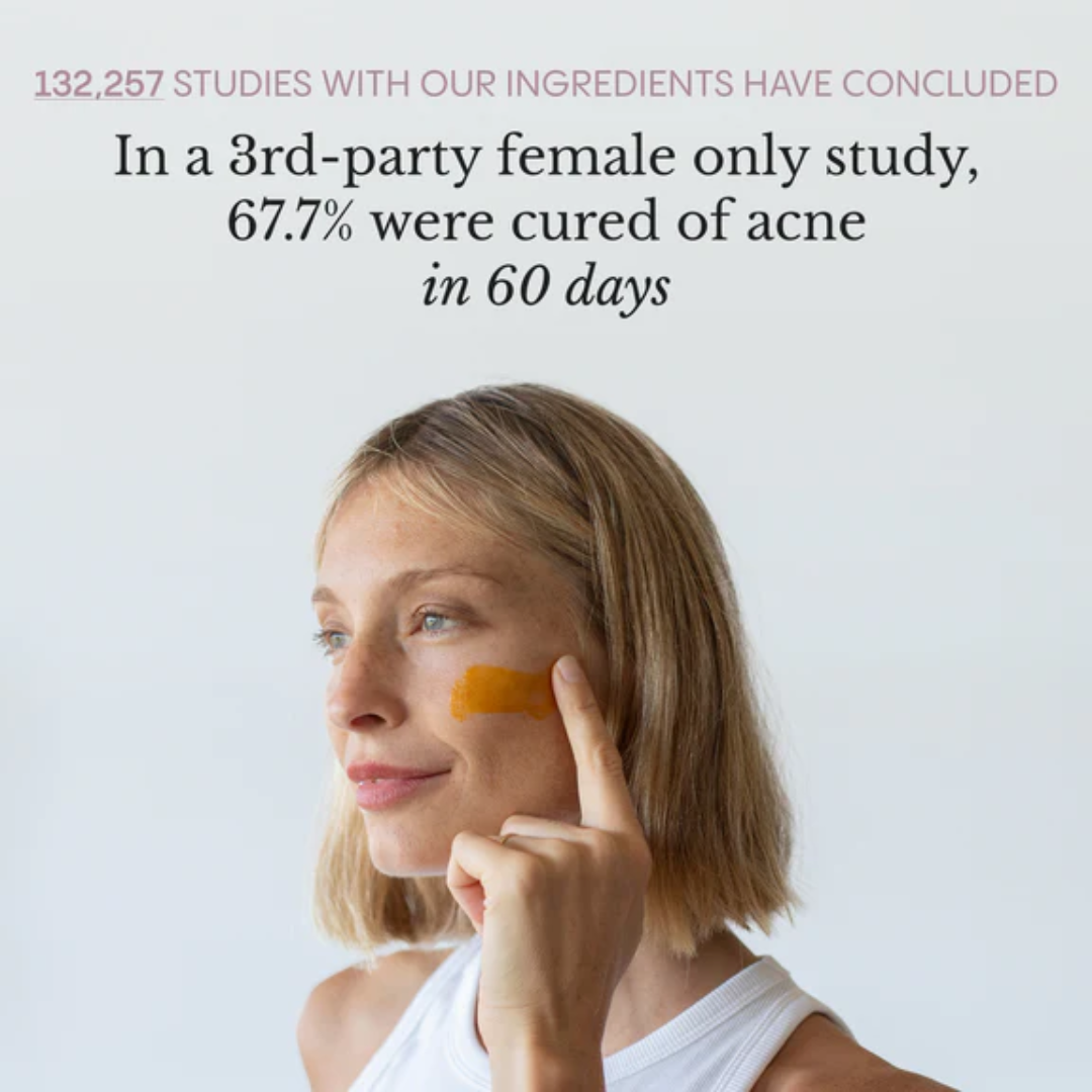 Acne & Redness Killer
