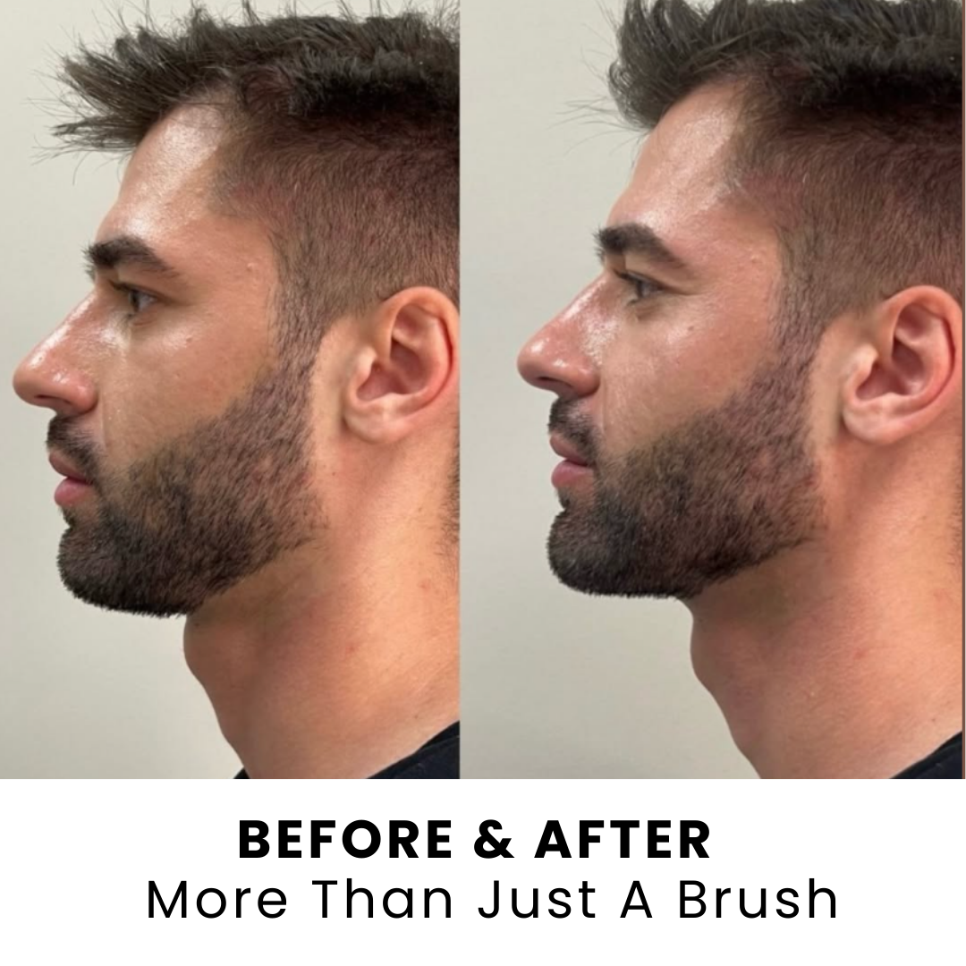 Lymphatic Sculptor™