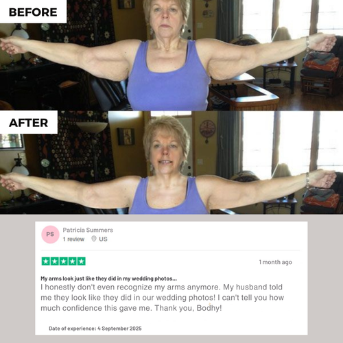Show Your Arms With Confidence.