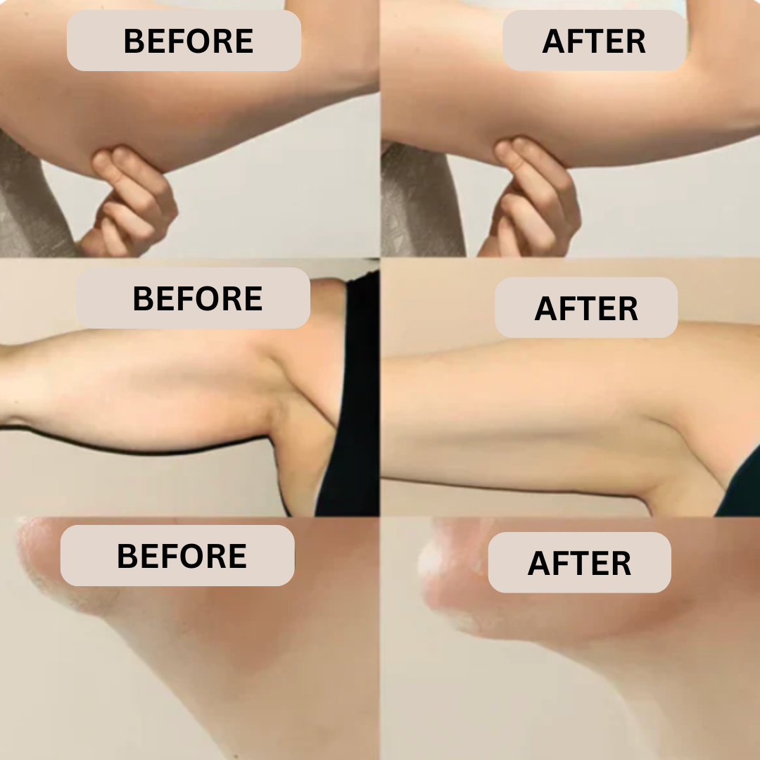 Lymphatic Drainage Support