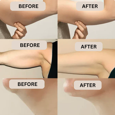 Lymphatic Drainage Support