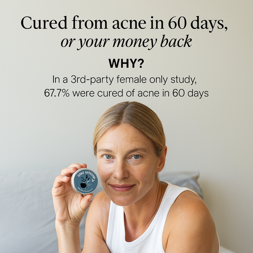 Acne & Redness Killer