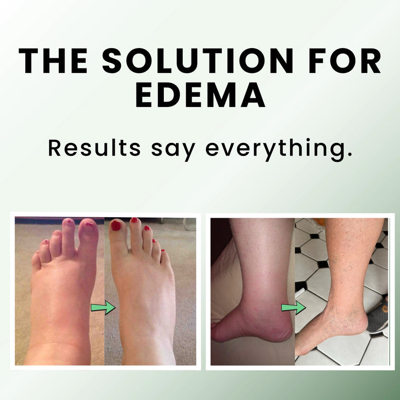 Bodhy™ Miracle Balm