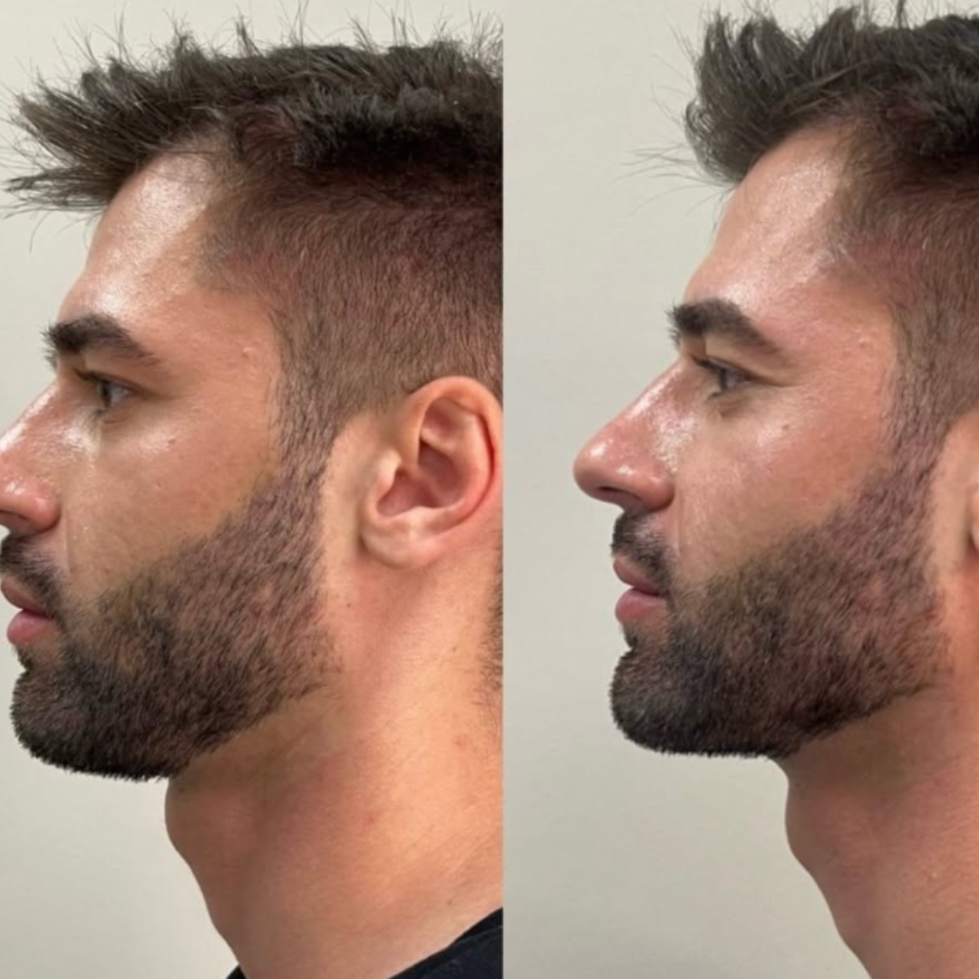 Feature product image